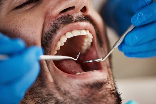 Best Teeth Whitening  in Louisburg, NC