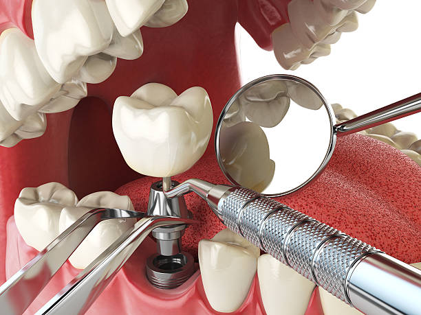 Best Cracked Tooth Emergency Dentist  in Louisburg, NC